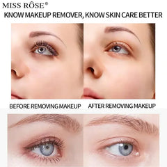 Miss Rose Thermal Micellar Water - 180ml