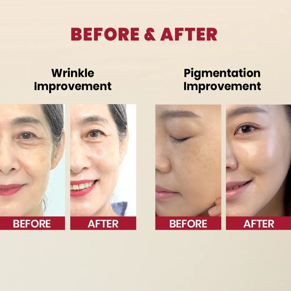 KSecret - Seoul 1988 Serum: Retinal Liposome 2% + Black Ginseng - 30ml