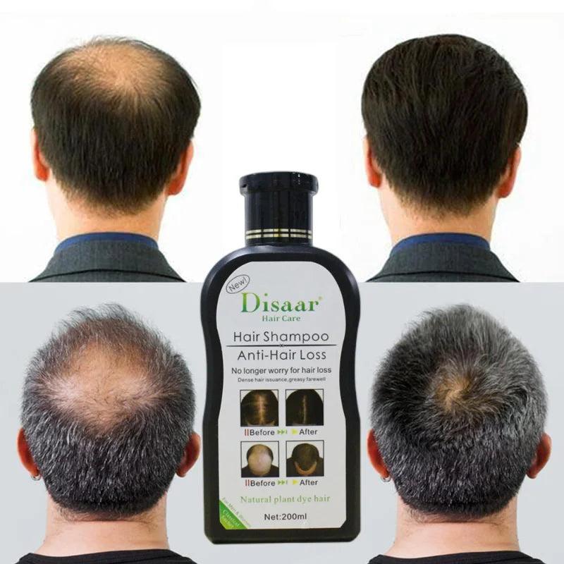Disaar Hair Shampoo Anti-Hair Loss - 200ml