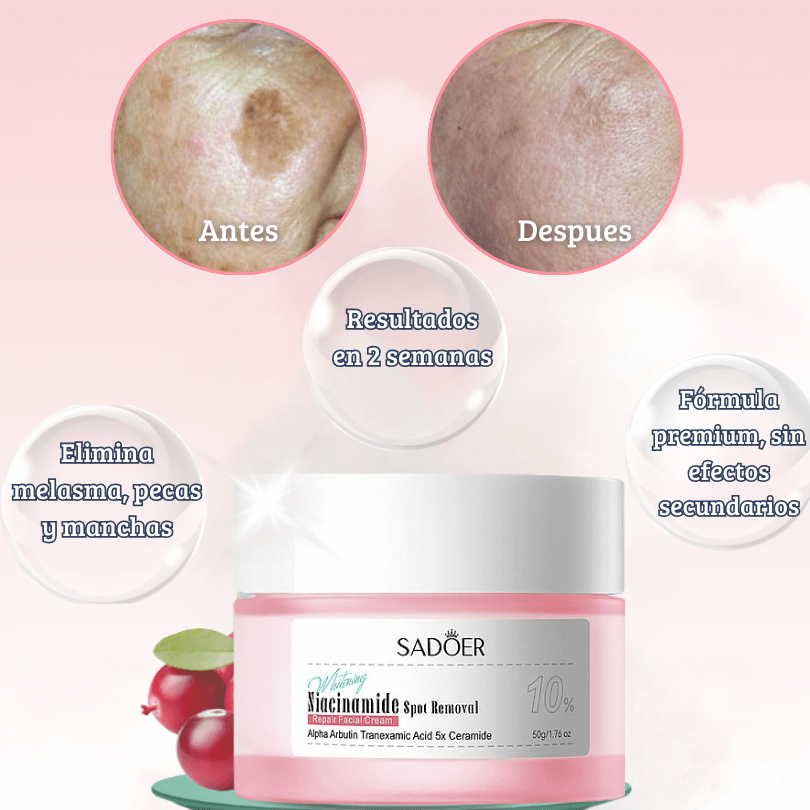 Sadoer Niacinamode Spot Remover Repair Cream 50g