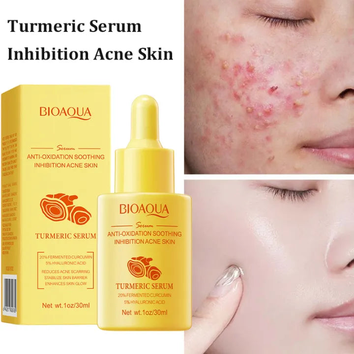 BIOAQUA Anti-Oxidation Acne Removal Turmeric Face Serum- 30ml