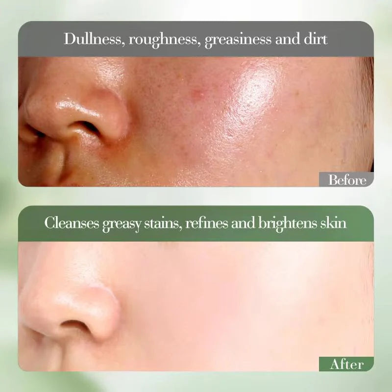 FAYANKOU Orange Extract Vitamin C Whitening Cleanser – 100g