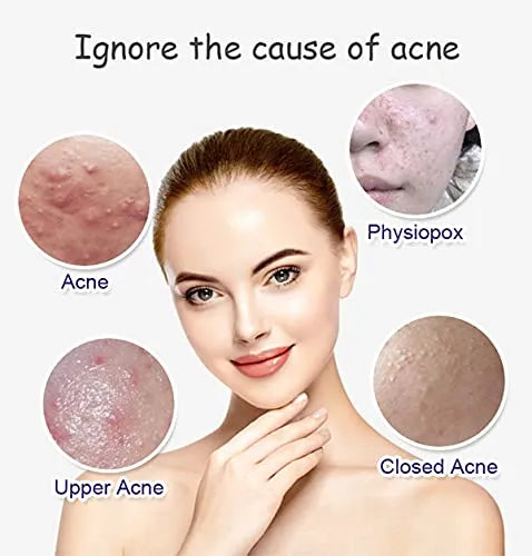 Aichun beauty Anti Acne Whitening Facial Serum - 30ml