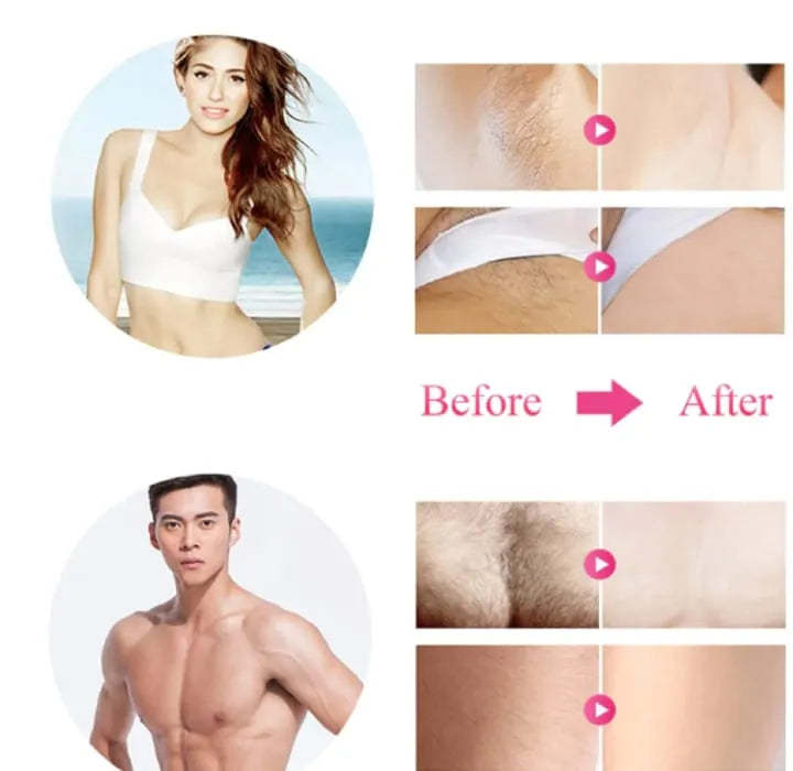 Babyverse IPL Laser Epilator Women Laser Hair Removal