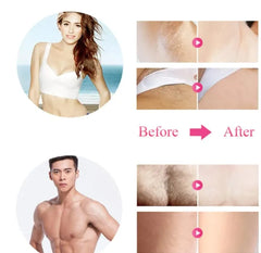 Babyverse IPL Laser Epilator Women Laser Hair Removal