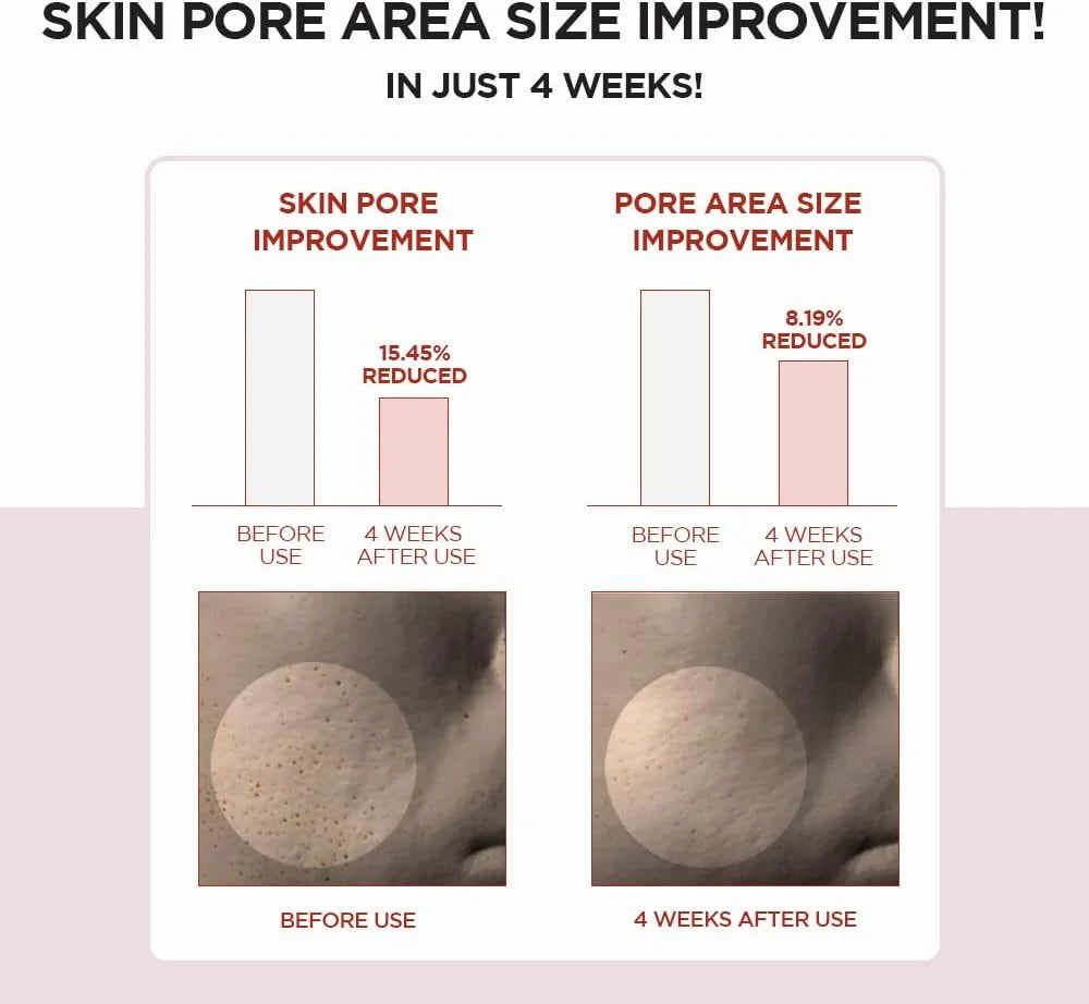 SKIN1004 - Madagascar Centella Poremizing Clear Toner -  210ml