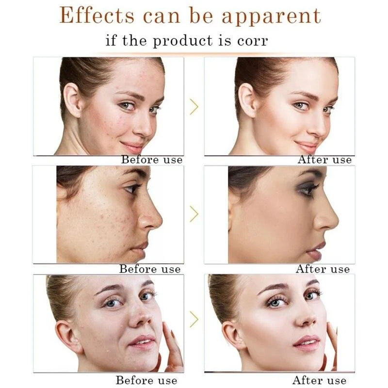 Bioaqua Avocado Moisturizer-Face Whitening Cream - 50gm