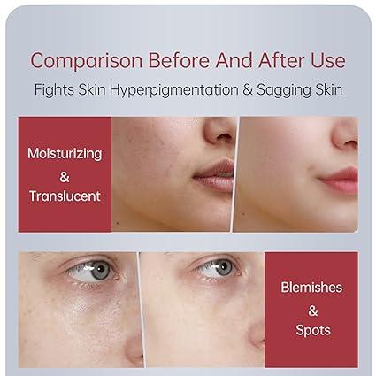 Zooson Freckle Cream Tube