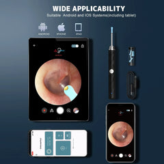 Ear Cleaner High Precision Ear Wax Removal Tool with Camera with LED Light