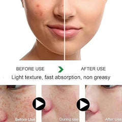 Zooson Freckle Cream Tube