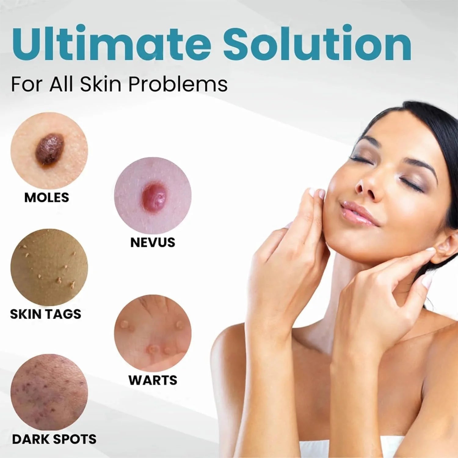 Non-Invasive Mole and Wart Removal Pen