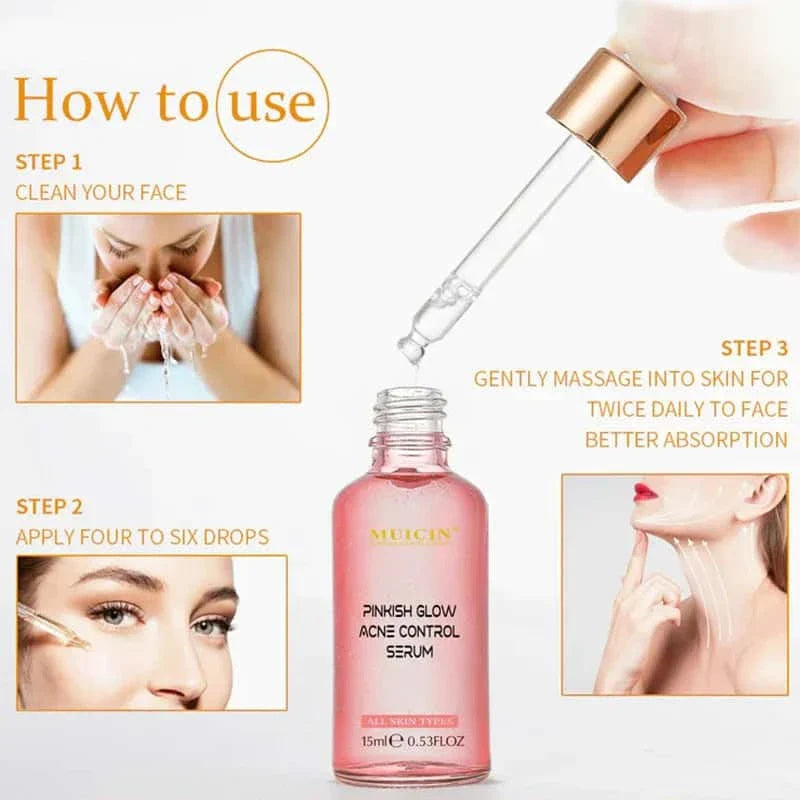 Muicin V9 Pinkish Glow Anti Acne Face Serum – 15ml