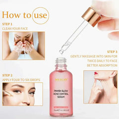 Muicin V9 Pinkish Glow Anti Acne Face Serum – 15ml