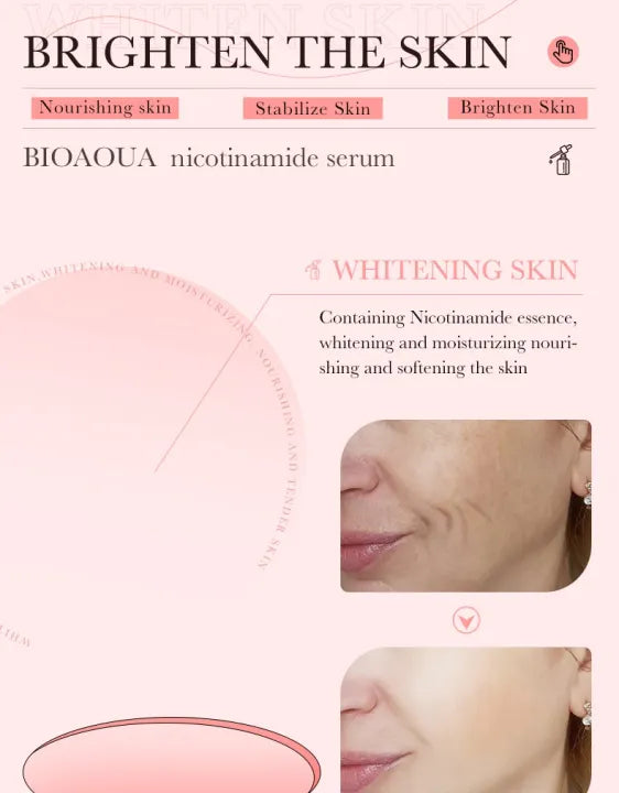 BIOAQUA Dispel Frekle Stable Soothing Nicotinamide Serum- 30ml