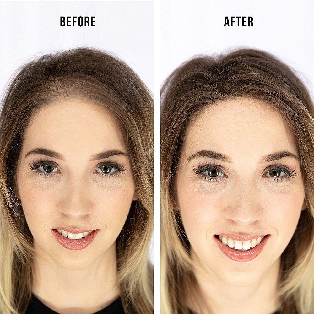 Dexe Hair Building Fibers 22g | For Men & Women