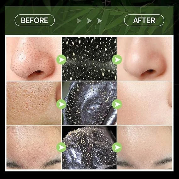 CHIRS'S UK Blackhead Peel Off Face Mask - 80g