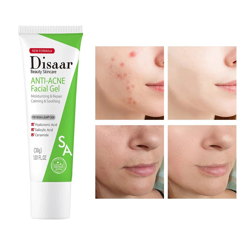 Disaar ceramide Anti-Acne Facial Gel Moisturizing Face Gel - 30g
