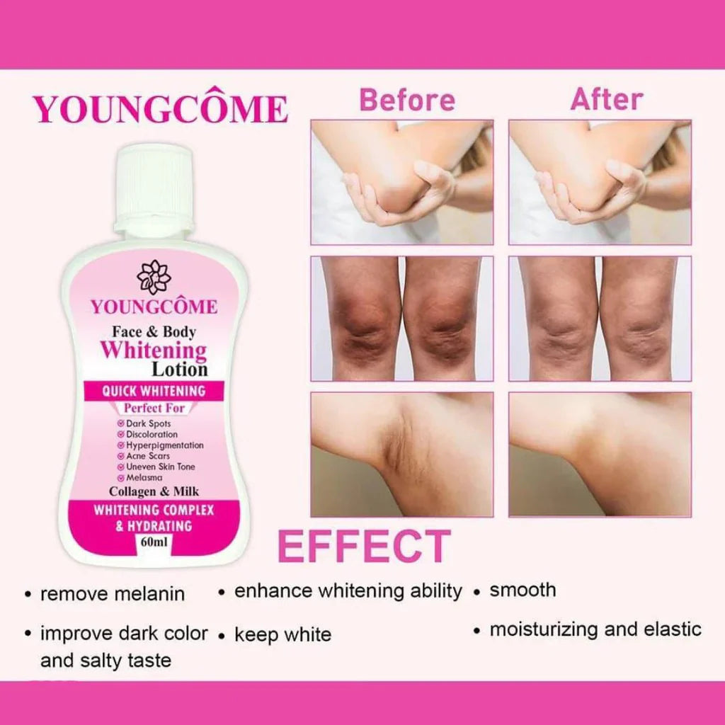 Youngcome Face & Body Whitening Lotion – 60ml
