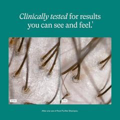 Nutrafol Root Purifier Scalp Microbiome Shampoo - 240ml