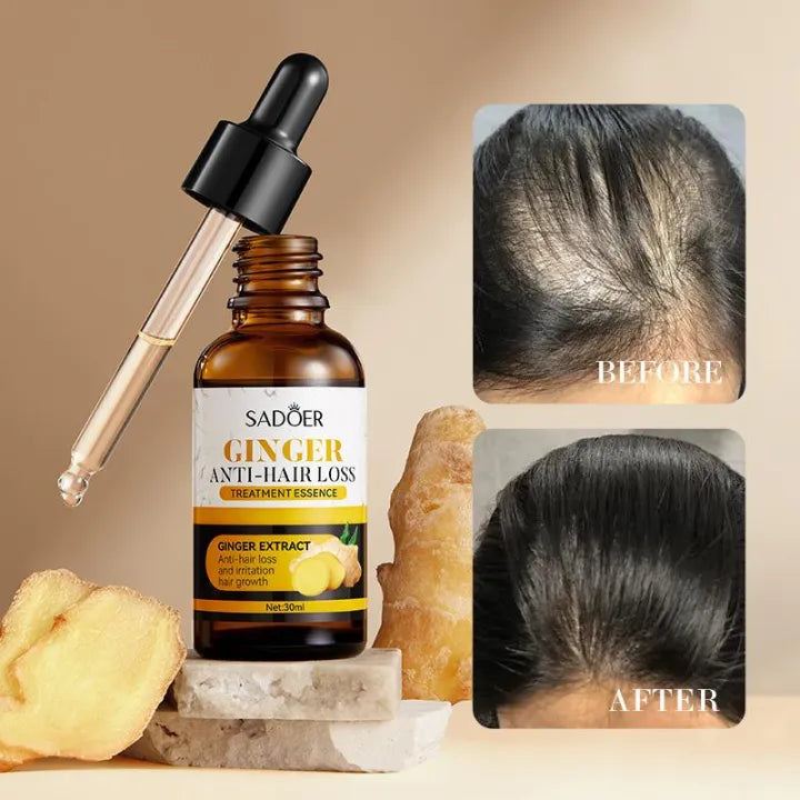 Sadoer Ginger Anti-Hair loss Treatment Oil