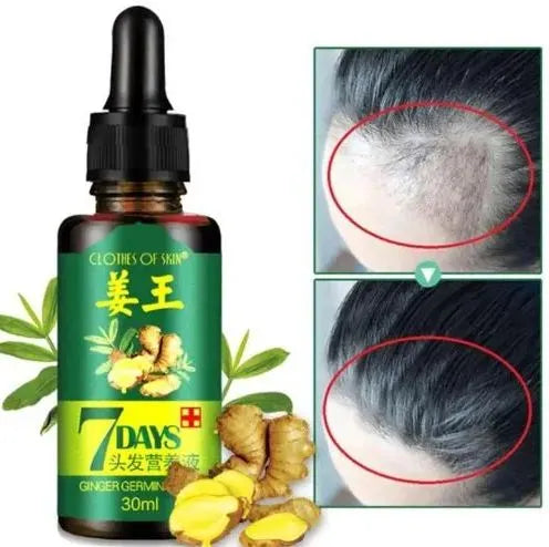 Aichun Beauty 7 Days Ginger Hair Growth Oil Serum For Damaged Hair - 30ml