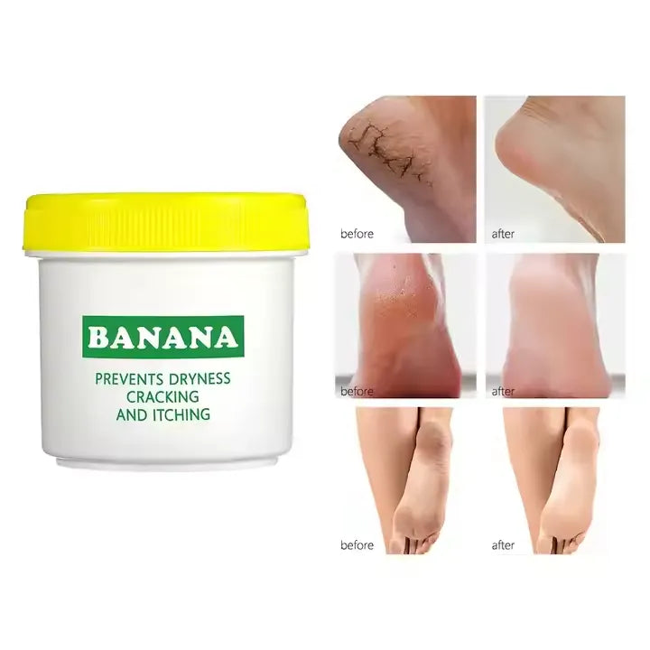 Aichun Beauty Organic Banana Extract Foot Cream