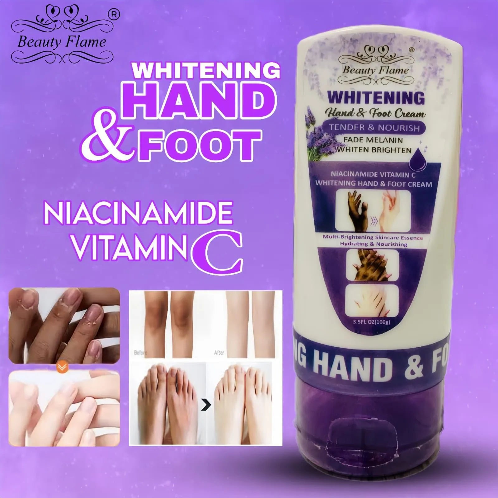BEAUTY FLAME Hand And Foot Whiteing Niacinamide And Vitamin C Cream 100g