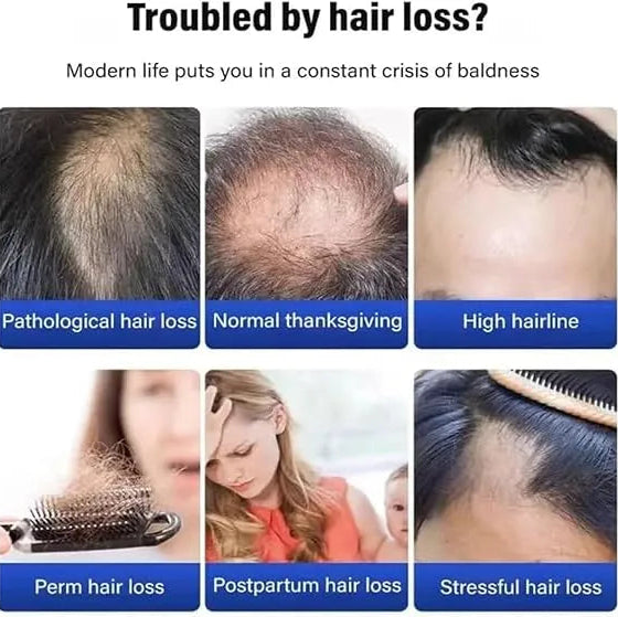 Bioaqua Horse Oil Anti Breakage Fluffy Shampoo - 300g