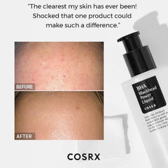 COSRX - BHA Blackhead Power Liquid - 100ml