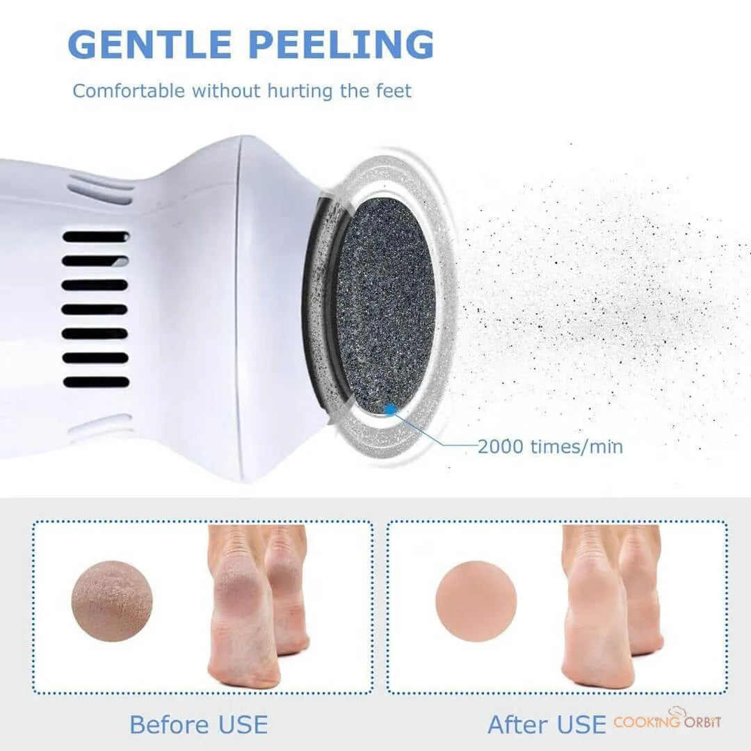 Callus Remover With Built-In Vacuum Electric Foot Grinder