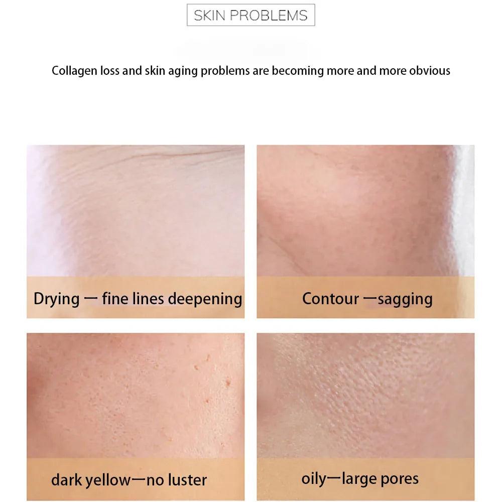 Cindynal Collagen Pearl Cream - 30g