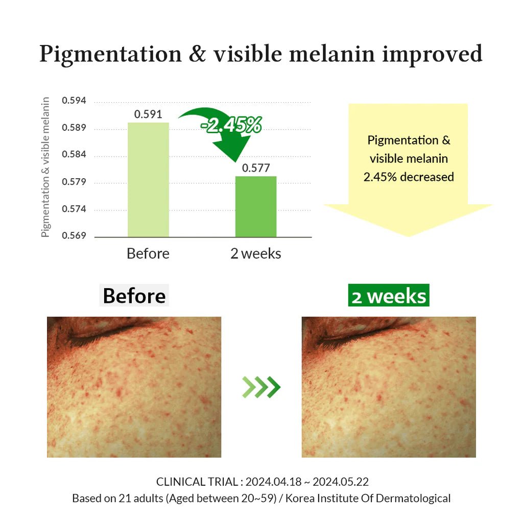 Dr.Althea Gentle Vitamin C Serum - 30ml