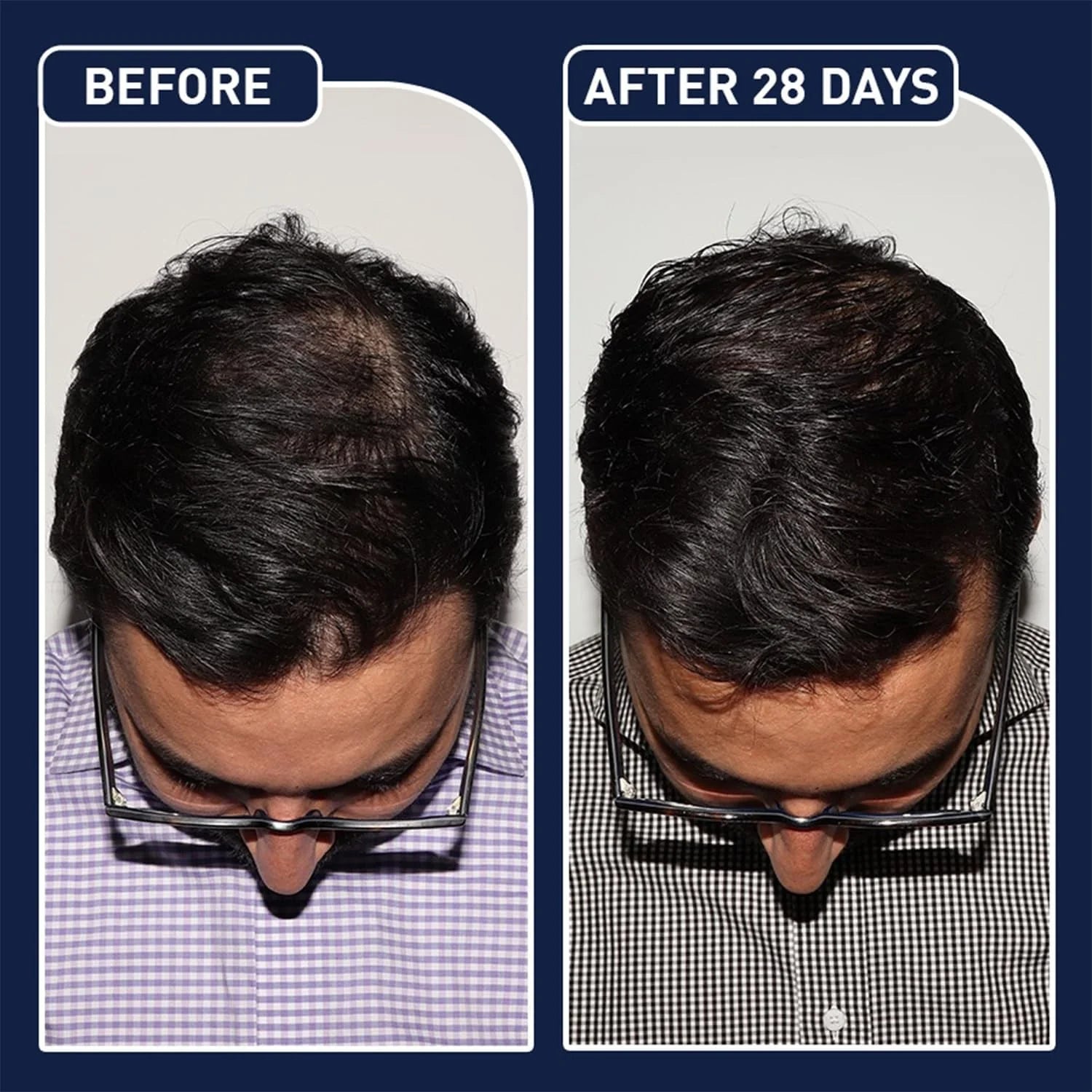 FEGPLUS Hair & Beard Growth Spary – 50ml