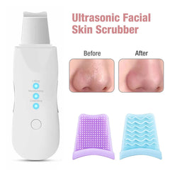 Face Scrubber Machine For Blackhead