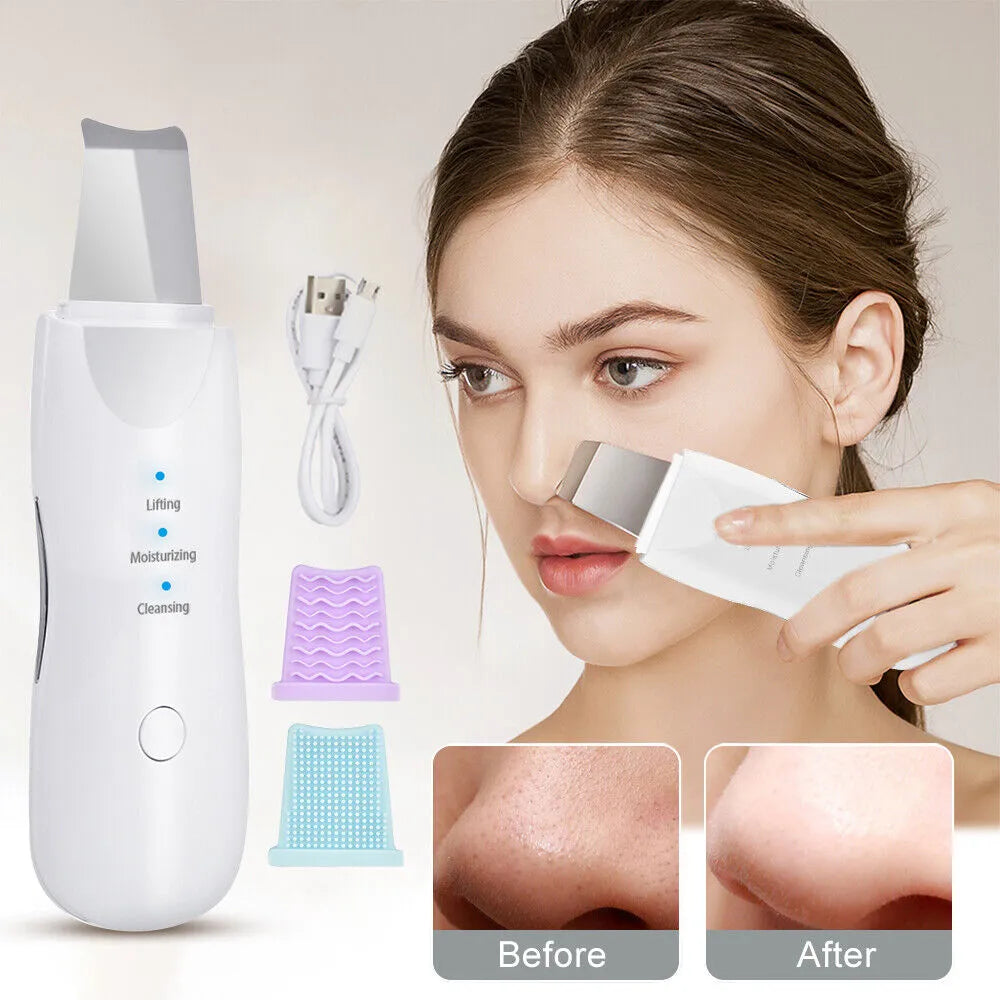 Face Scrubber Machine For Blackhead