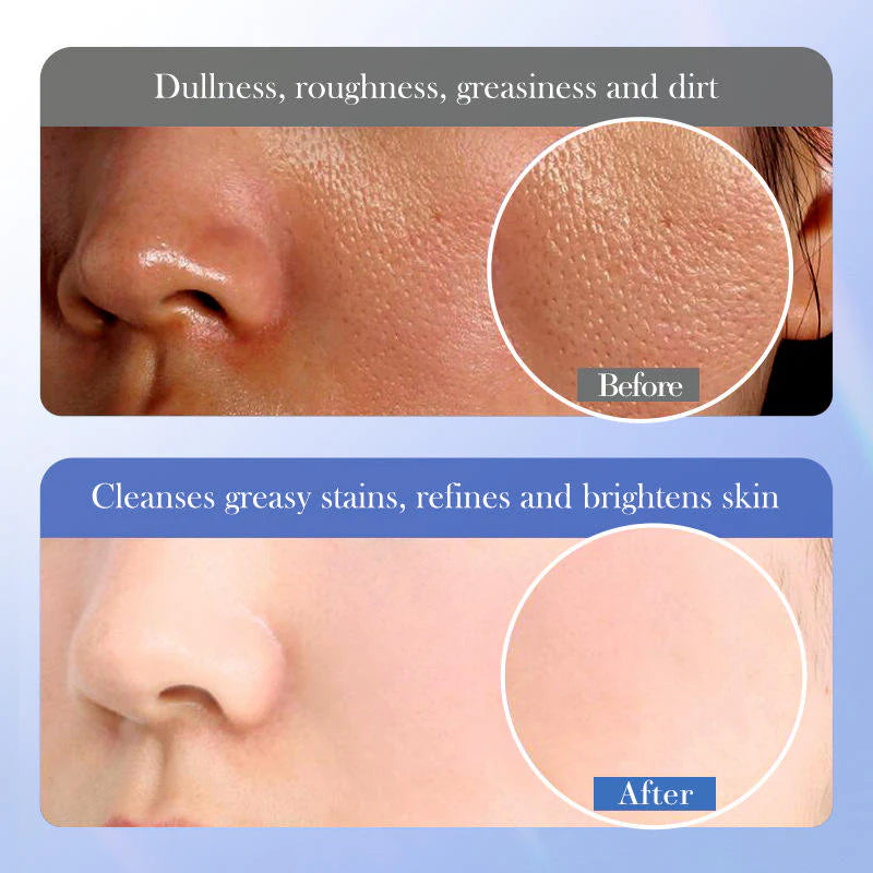 BIOAQUA Ceramide Salicylic Acid Facial Cleanser - 100ml