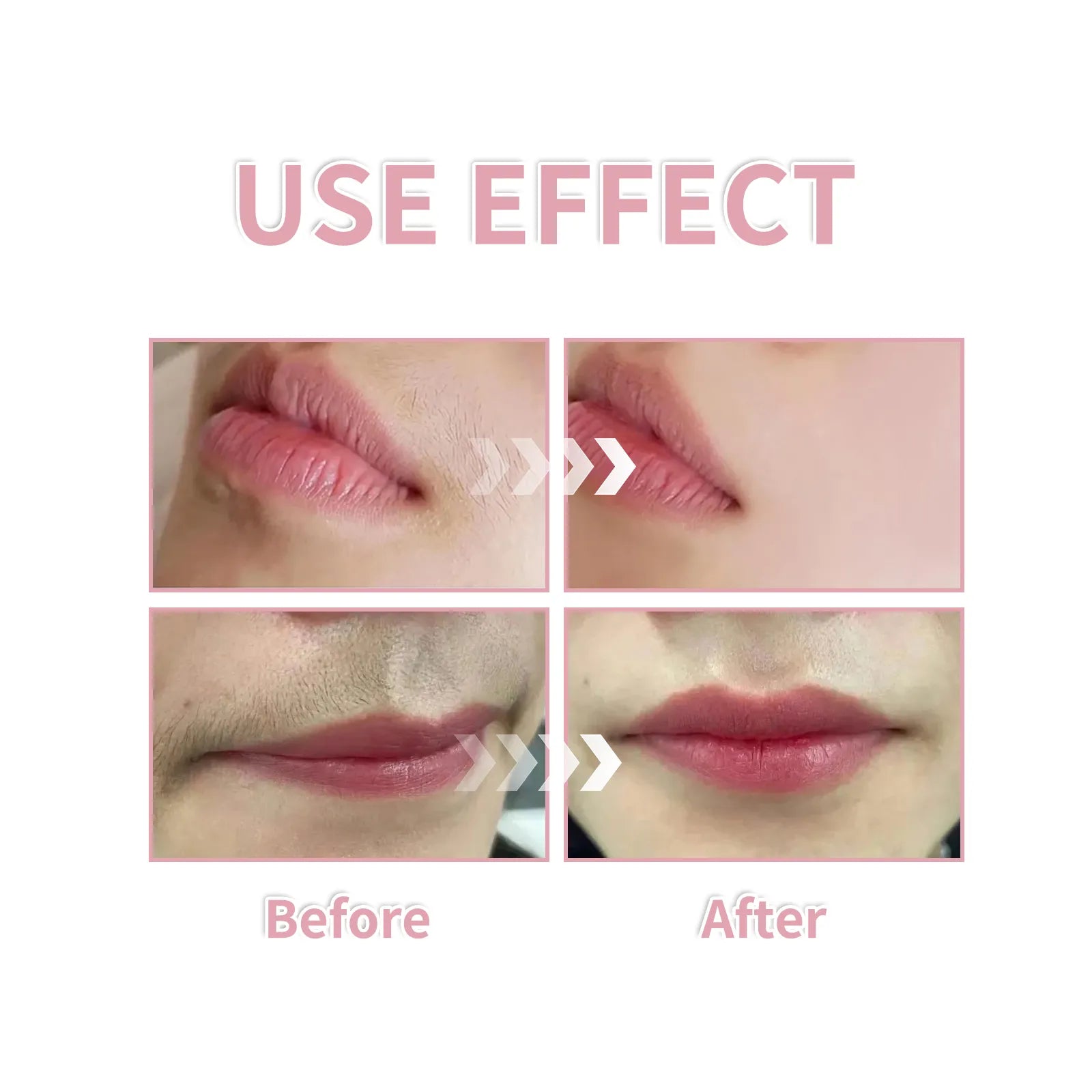 Hair Identifier Spray Set For Face Shaving 100ml