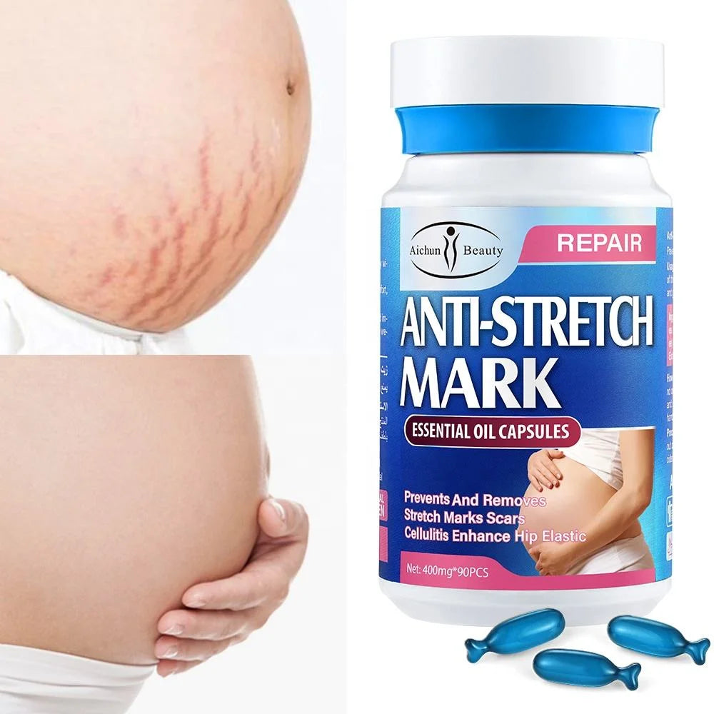 Aichun Beauty Oil Removal Scar Stretch Marks Oil for Women - 90 Pcs