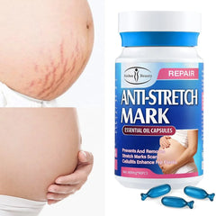 Aichun Beauty Oil Removal Scar Stretch Marks Oil for Women - 90 Pcs