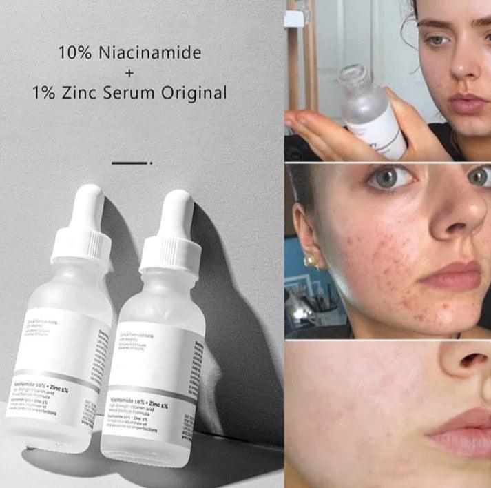 The Ordinary Hyaluronic Acid 2% + B5 - 30ml