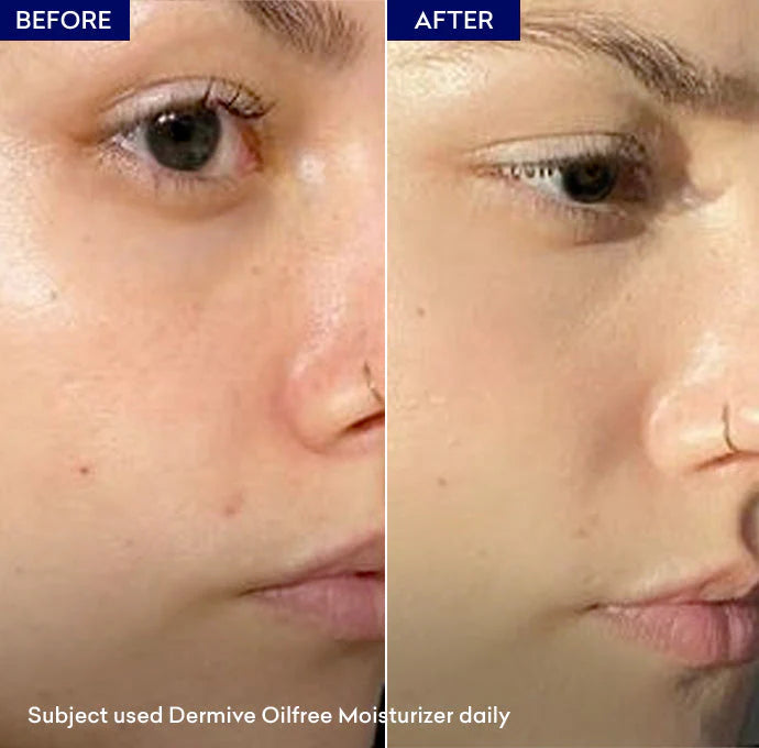 Jenpharm Dermive Oil Free Moisturizer Spf 20 - 100ml - Factory Leftover