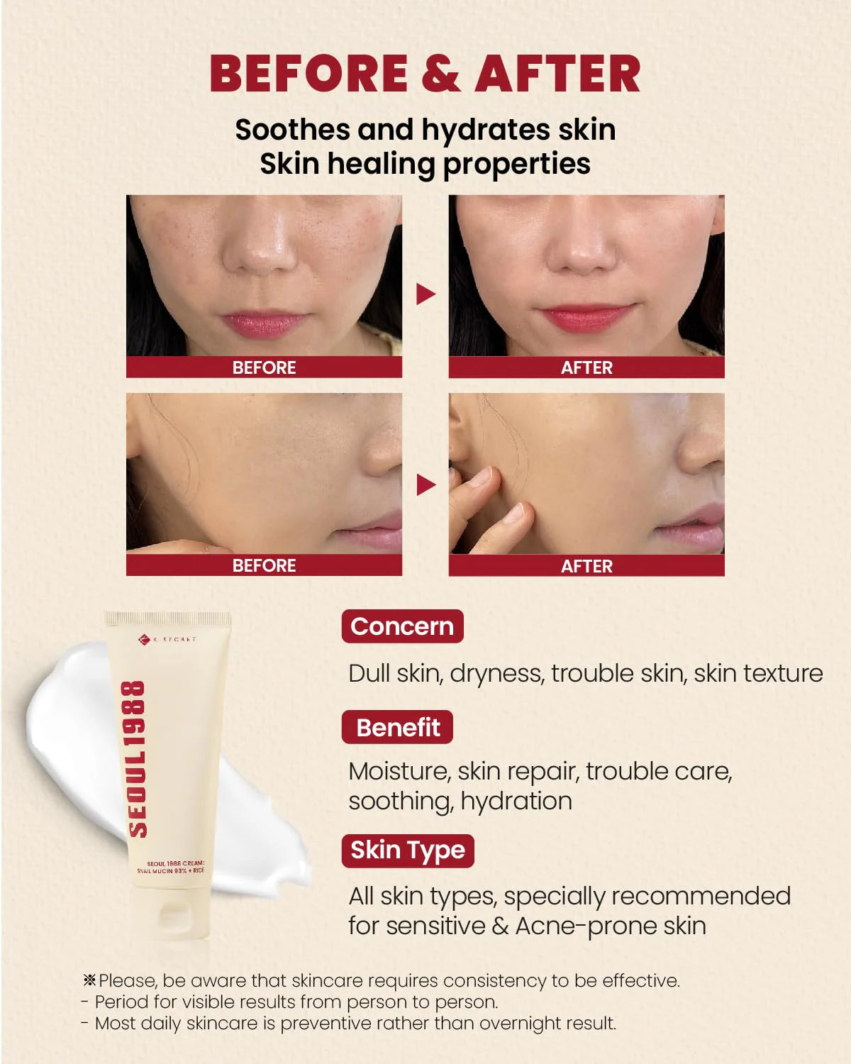 K-Secret Seoul 1988 Snail Mucin 93% + Rice Cream  - 100ml - Made in Korea