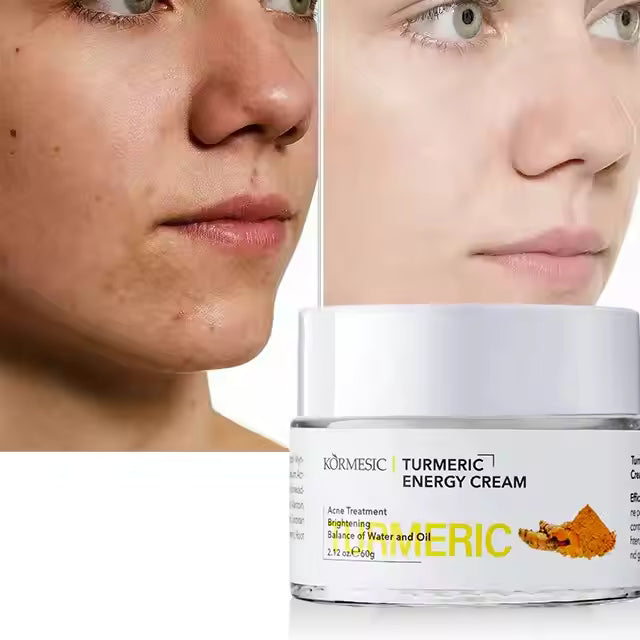 KORMESIC Turmeric Energy Cream - 60g