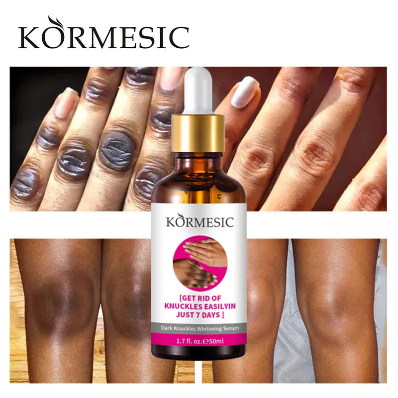 KORMESIC Dark Knuckle whitening Brightening Serum 50ml