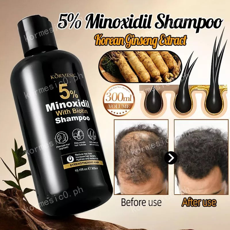 KORMESIC Minoxidil with Biotin Hair Grower Shampoo - 300ml