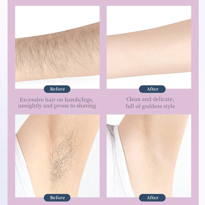 Kemei LCD Electric Tweezers Dry wet Use Portable Epilator