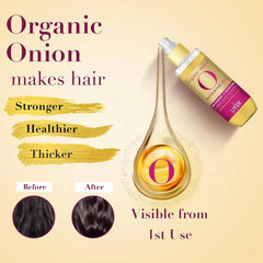 Livon Organic Onion Repairing Serum Oil For Stronger and Thicker Hair - 100ml