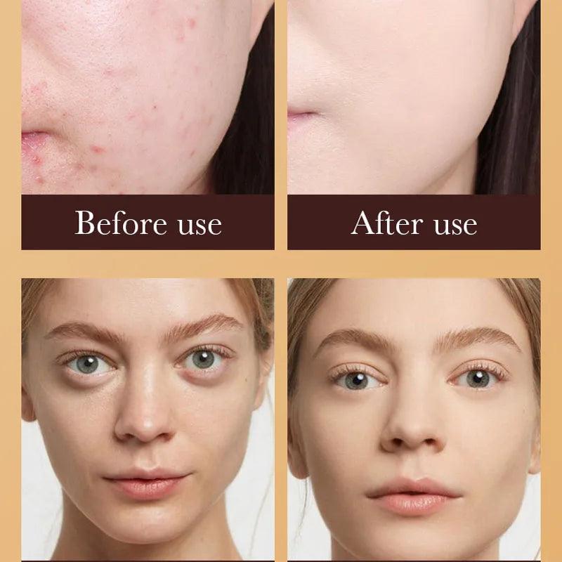 Sadoer Gold Snail Sunscreen BB Cream