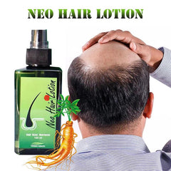 Neo Hair Lotion with Free Derma Roller (Made in P.R.C)
