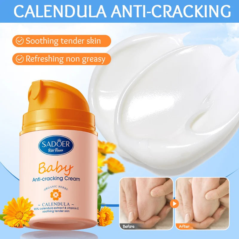 SADOER Baby Calendula Vitamin E Gentle Soothing Anti-Cracking Cream - 50g